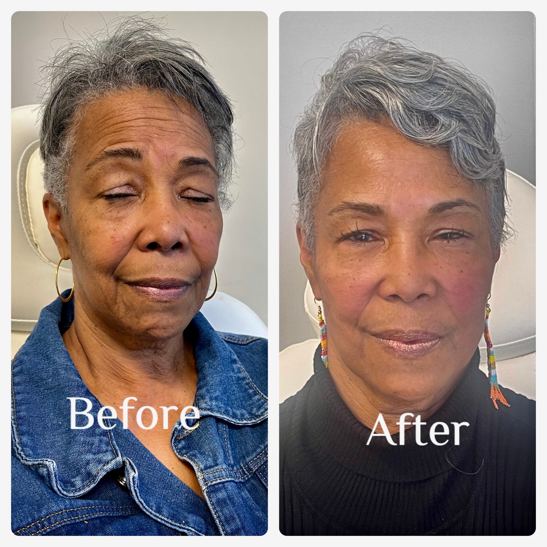 Client result — Medical Aesthetic Center of Georgia