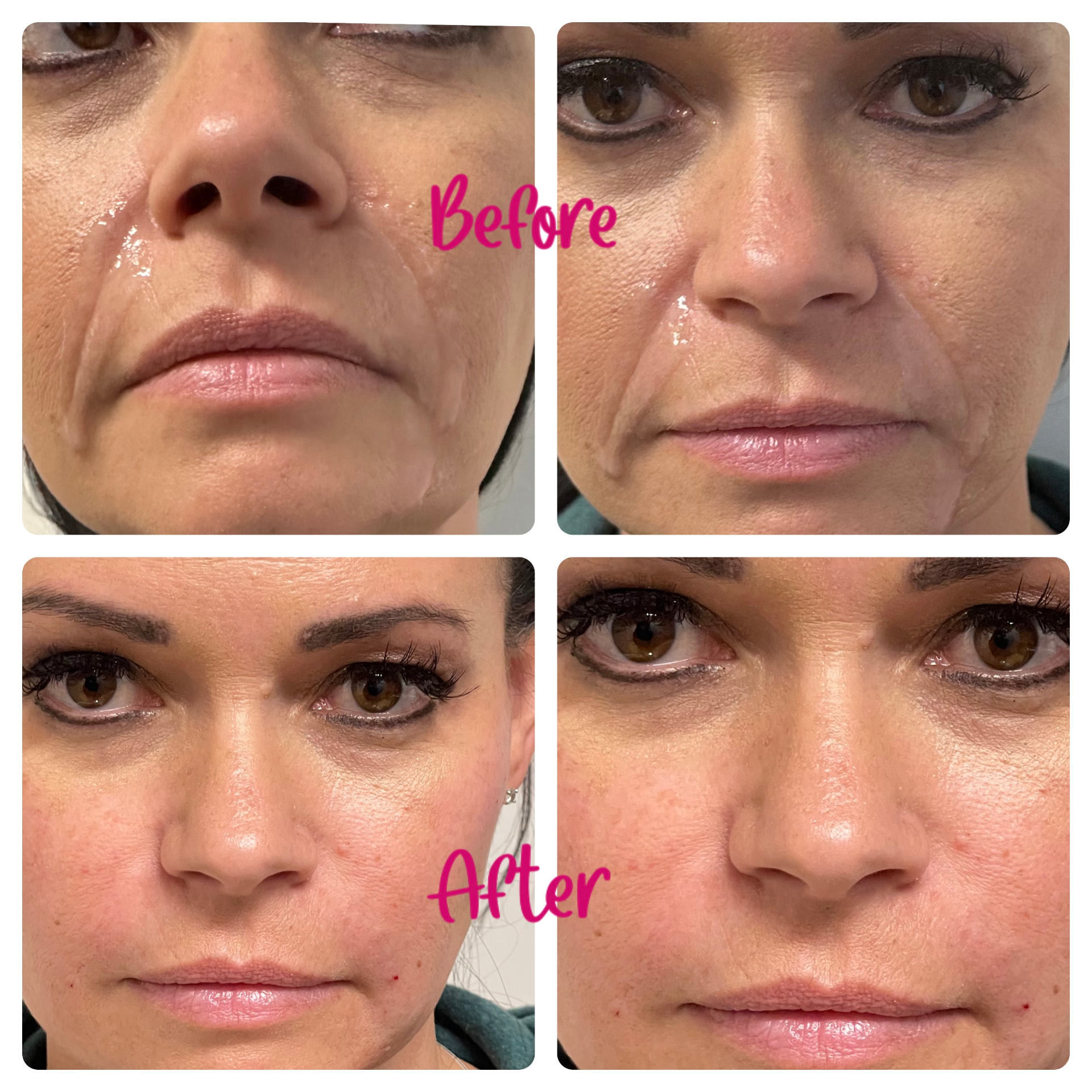 Client result — Medical Aesthetic Center of Georgia