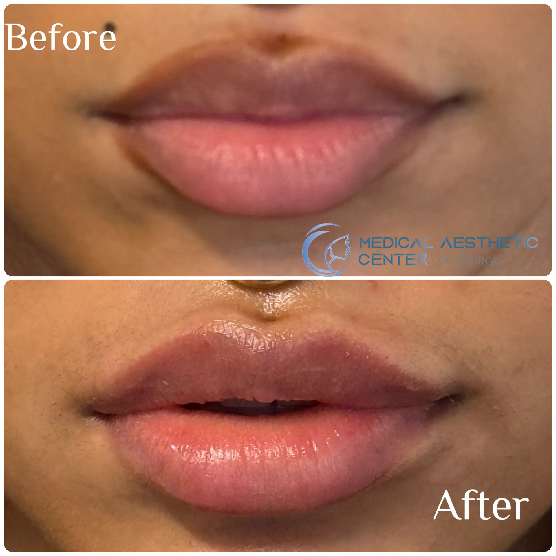 Client result — Medical Aesthetic Center of Georgia