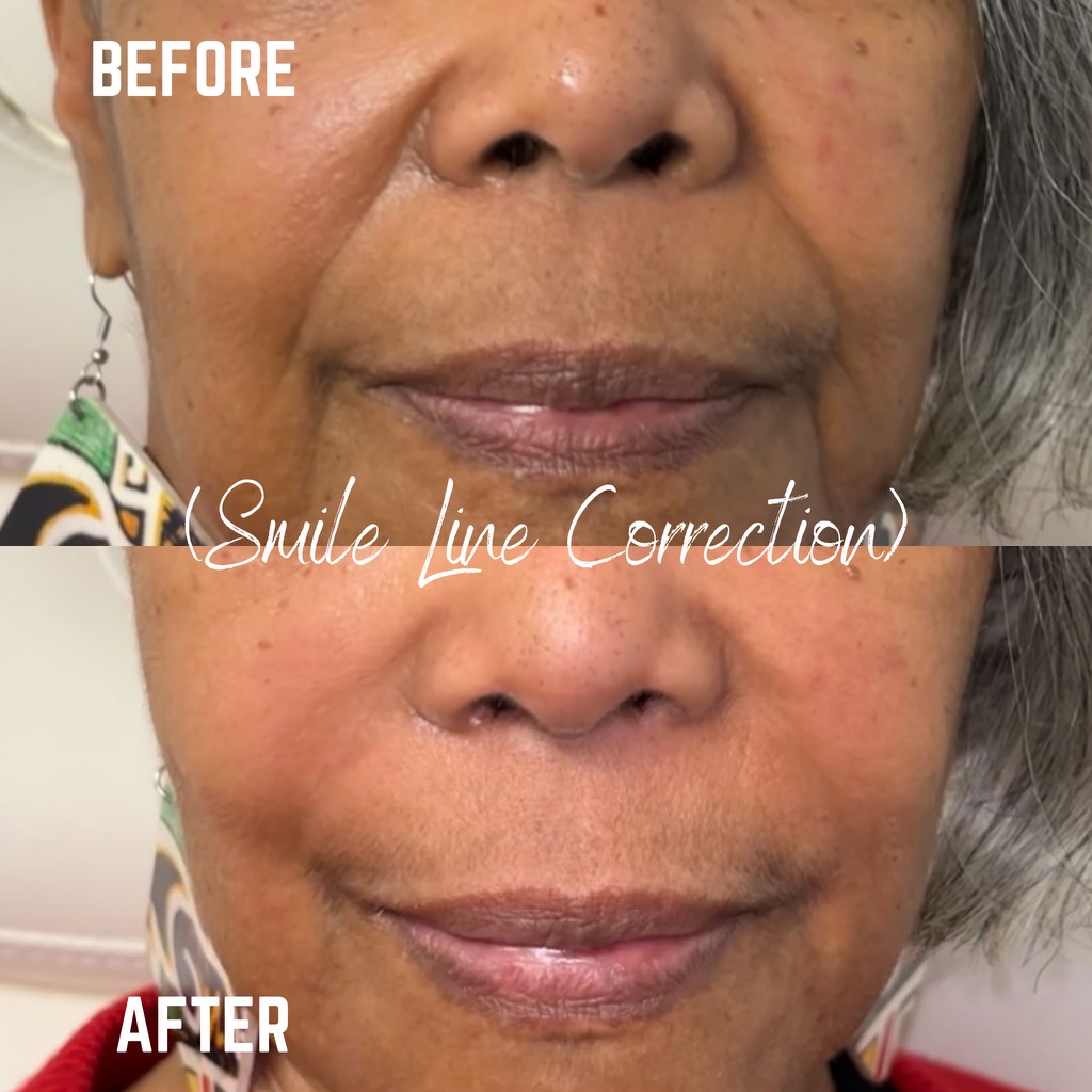 Client result — Medical Aesthetic Center of Georgia