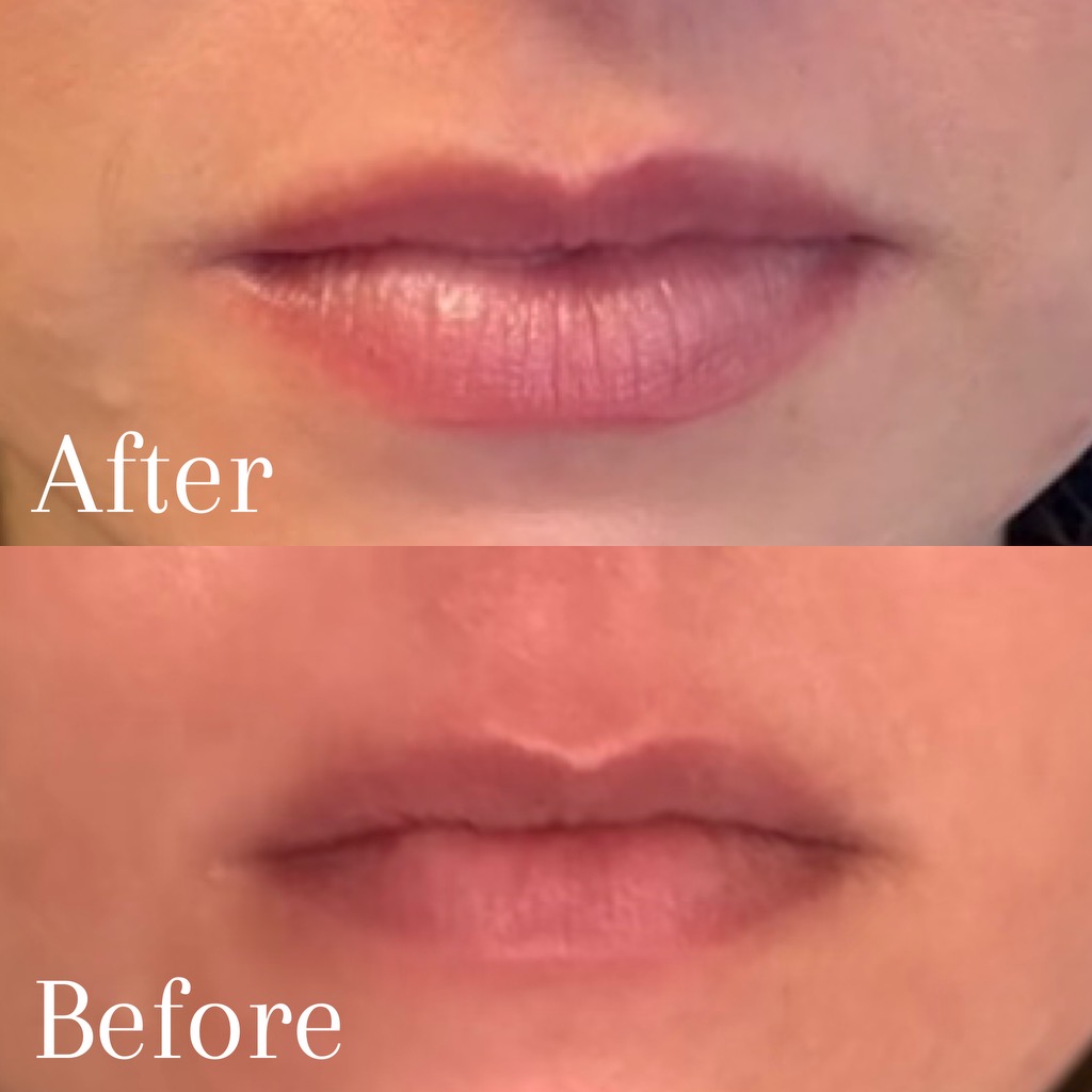 Client result — Medical Aesthetic Center of Georgia