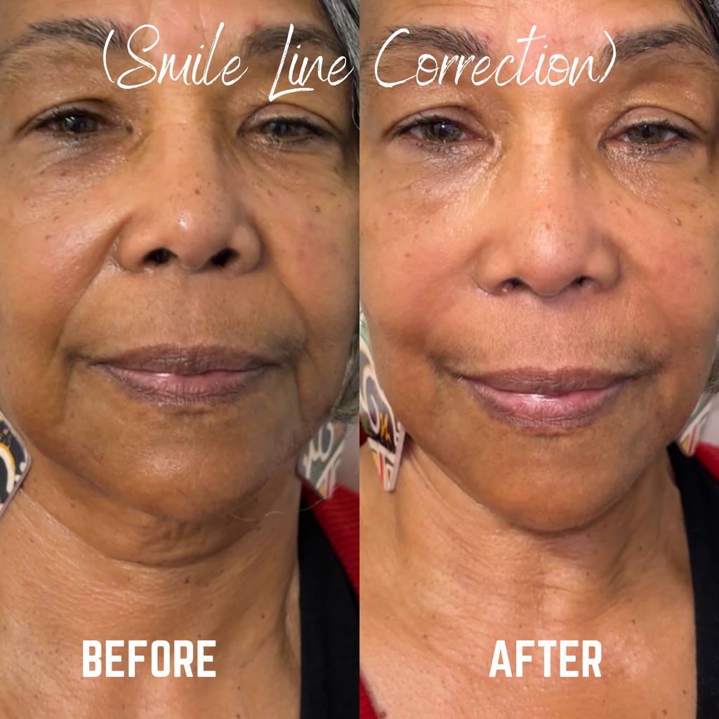 Client result — Medical Aesthetic Center of Georgia