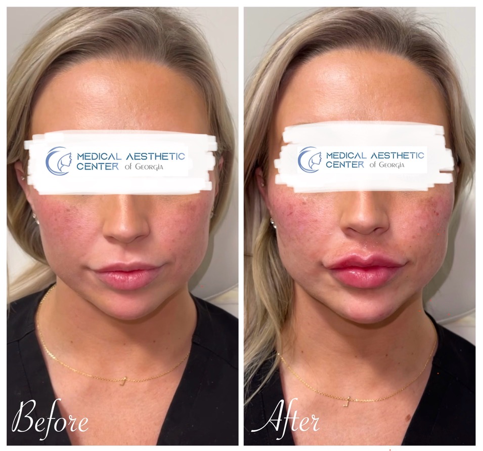 Client result — Medical Aesthetic Center of Georgia
