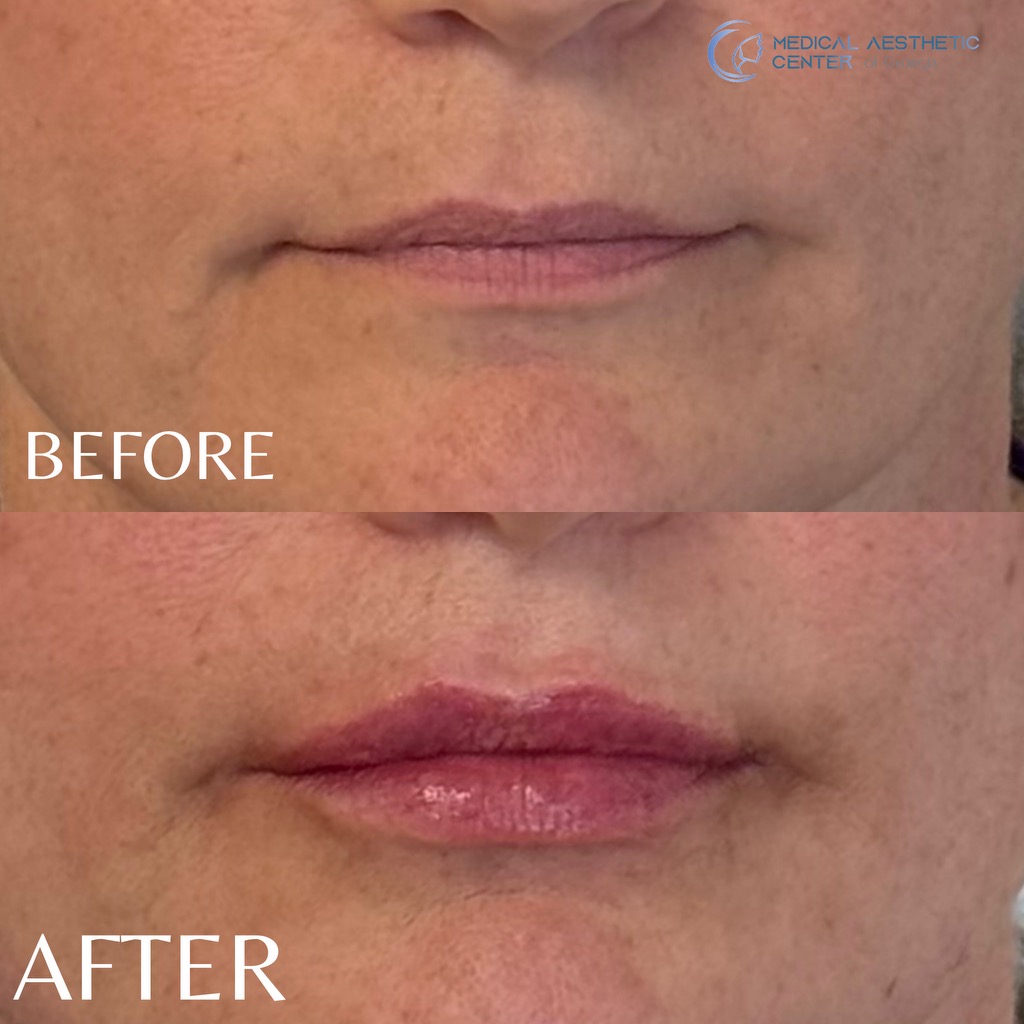 Client result — Medical Aesthetic Center of Georgia