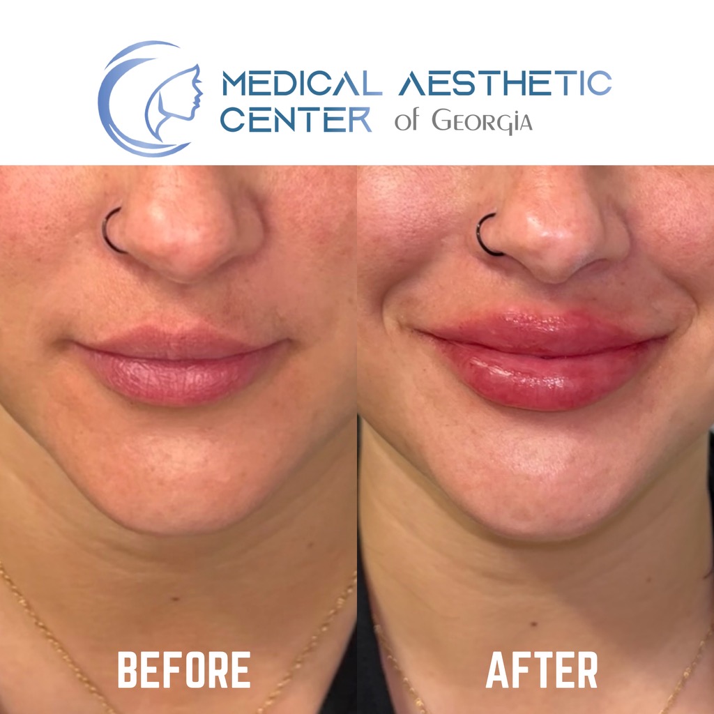 Client result — Medical Aesthetic Center of Georgia