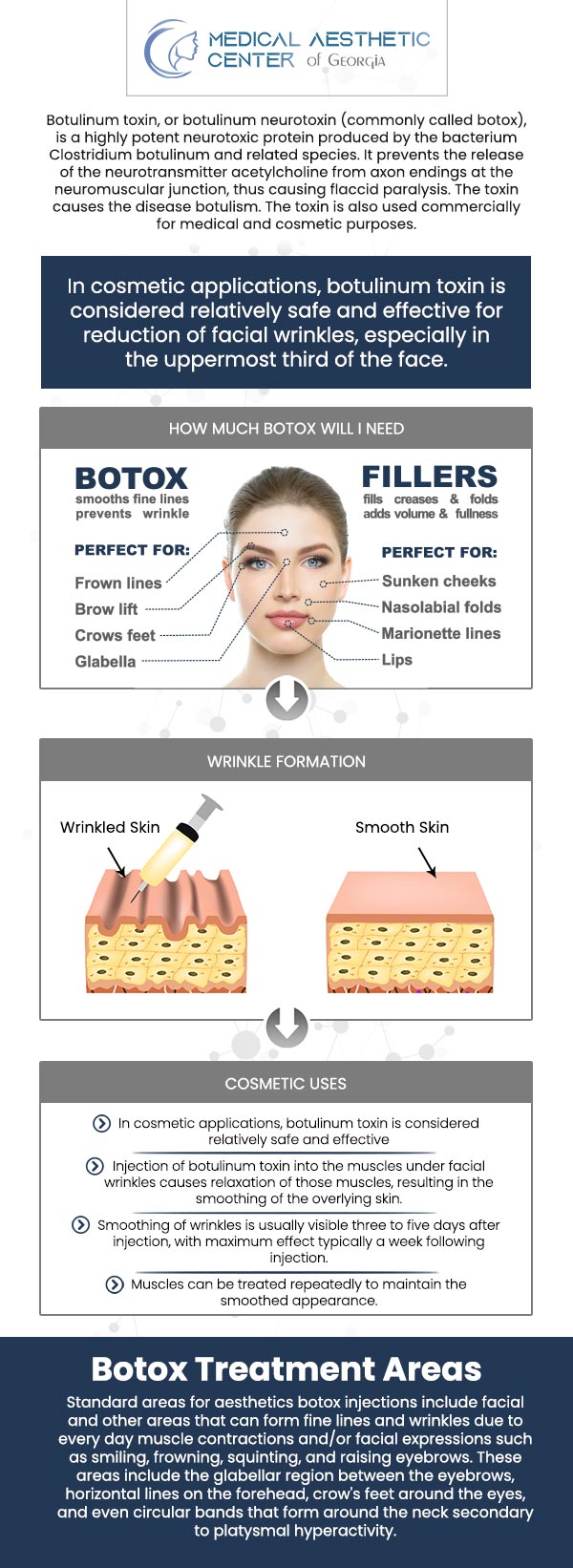 Common questions asked by patients: What is Botox, and how does it work? What cosmetic concerns can Botox treat? How long has Botox been used, and is it FDA-approved? How do I choose a qualified provider for Botox injections? Are consultations available to create a personalized treatment plan? For more information, contact us or request an appointment online. We are conveniently located at 1425 Georgia Ave Suite 201C, Macon, GA 31201.