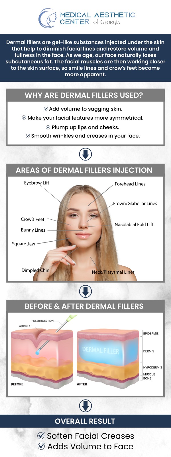 Dr. Reuben K. Ellis, a dermal fillers specialist at the Medical Aesthetic Center of Georgia in Macon, GA, offers expert treatments to restore volume and smooth wrinkles. Dermal fillers are a non-surgical solution designed to enhance facial features and rejuvenate your appearance. Whether you're looking to add fullness to your cheeks, soften smile lines, or plump your lips, we customize each treatment to fit your unique needs. For more information, contact us or request an appointment online. We are conveniently located at 1425 Georgia Ave Suite 201C, Macon, GA 31201.