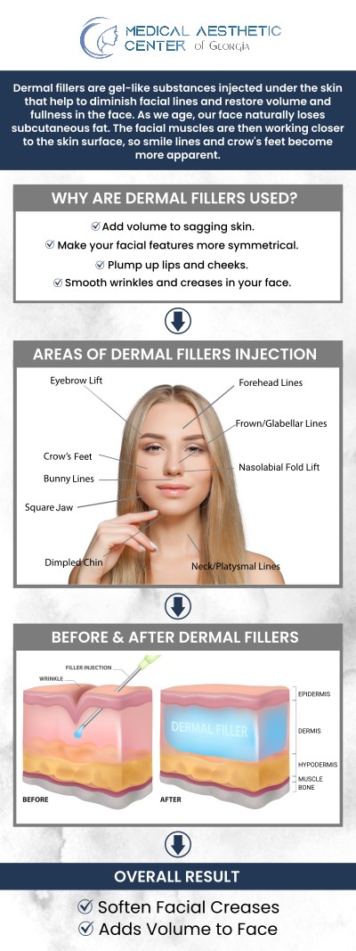 Dr. Reuben K. Ellis, a dermal fillers specialist at the Medical Aesthetic Center of Georgia in Macon, GA, offers expert treatments to restore volume and smooth wrinkles. Dermal fillers are a non-surgical solution designed to enhance facial features and rejuvenate your appearance. Whether you're looking to add fullness to your cheeks, soften smile lines, or plump your lips, we customize each treatment to fit your unique needs. For more information, contact us or request an appointment online. We are conveniently located at 1425 Georgia Ave Suite 201C, Macon, GA 31201.