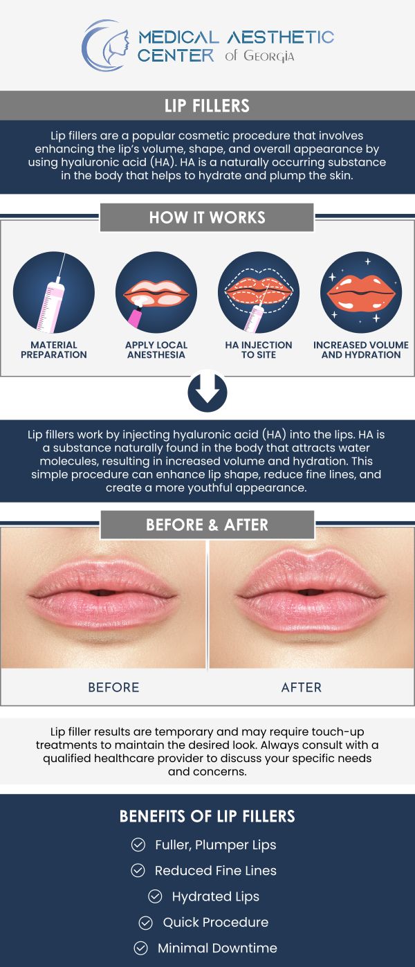 Common questions asked by patients: What are lip fillers, and how do they work? What substances are most commonly used in lip fillers? How do lip fillers differ from permanent lip implants? What cosmetic concerns can lip fillers address? For more information, contact us or request an appointment online. We are conveniently located at 1425 Georgia Ave Suite 201C, Macon, GA 31201.