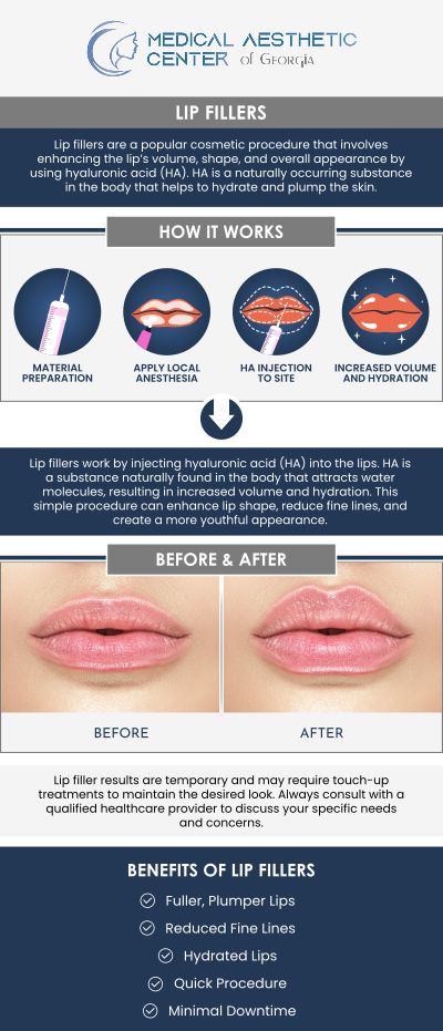 Common questions asked by patients: What are lip fillers, and how do they work? What substances are most commonly used in lip fillers? How do lip fillers differ from permanent lip implants? What cosmetic concerns can lip fillers address? For more information, contact us or request an appointment online. We are conveniently located at 1425 Georgia Ave Suite 201C, Macon, GA 31201.