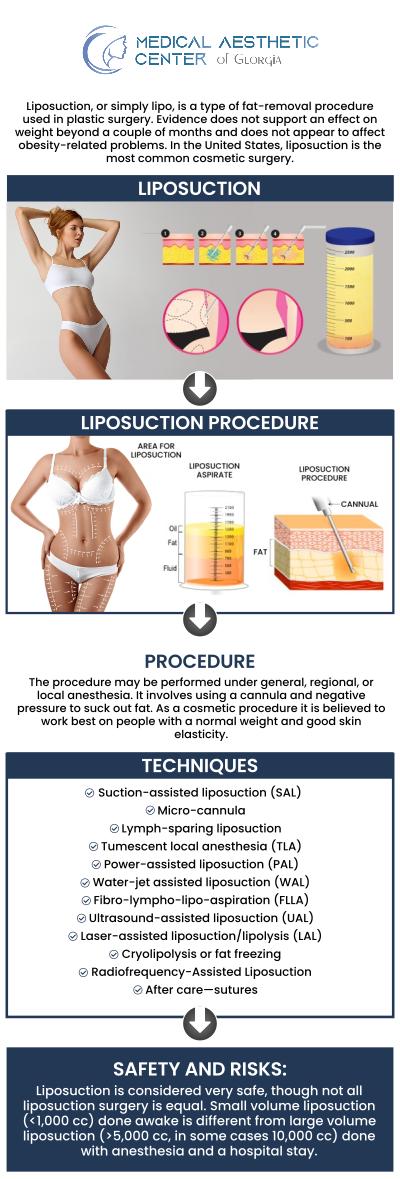 Common questions asked by patients: What is liposuction surgery, and how does it work? What areas of the body can be treated with liposuction? Is liposuction a weight loss solution or a body contouring procedure? How does liposuction compare to non-surgical fat reduction treatments like CoolSculpting or Lipodissolve? For more information, contact us or request an appointment online. We are conveniently located at 1425 Georgia Ave Suite 201C, Macon, GA 31201. Common questions asked by patients: What is liposuction surgery, and how does it work? What areas of the body can be treated with liposuction? Is liposuction a weight loss solution or a body contouring procedure? How does liposuction compare to non-surgical fat reduction treatments like CoolSculpting or Lipodissolve? For more information, contact us or request an appointment online. We are conveniently located at 1425 Georgia Ave Suite 201C, Macon, GA 31201.