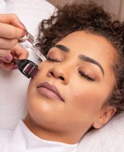 Microneedling Near Me in Macon, GA