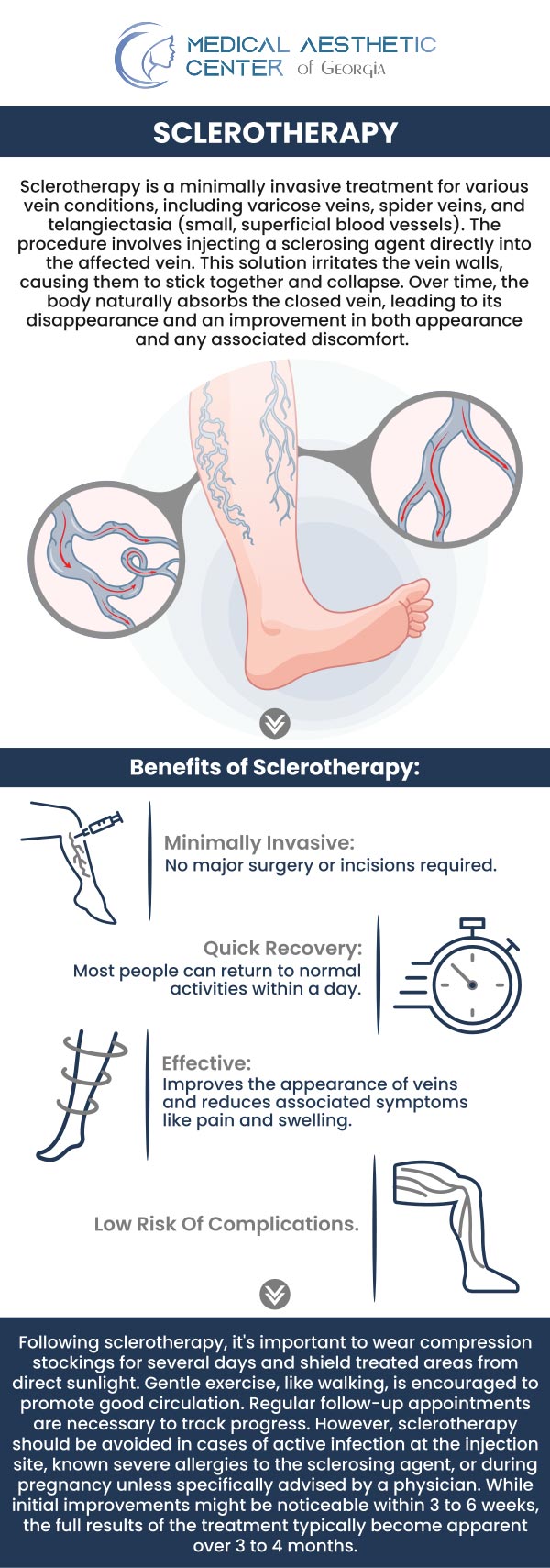 Common questions asked by patients: What is sclerotherapy, and how does it work? What types of veins can be treated with sclerotherapy? How does sclerotherapy compare to laser vein treatments or surgery? What happens during a sclerotherapy session? How long does the procedure usually take? For more information, contact us or request an appointment online. We are conveniently located at 1425 Georgia Ave Suite 201C, Macon, GA 31201.