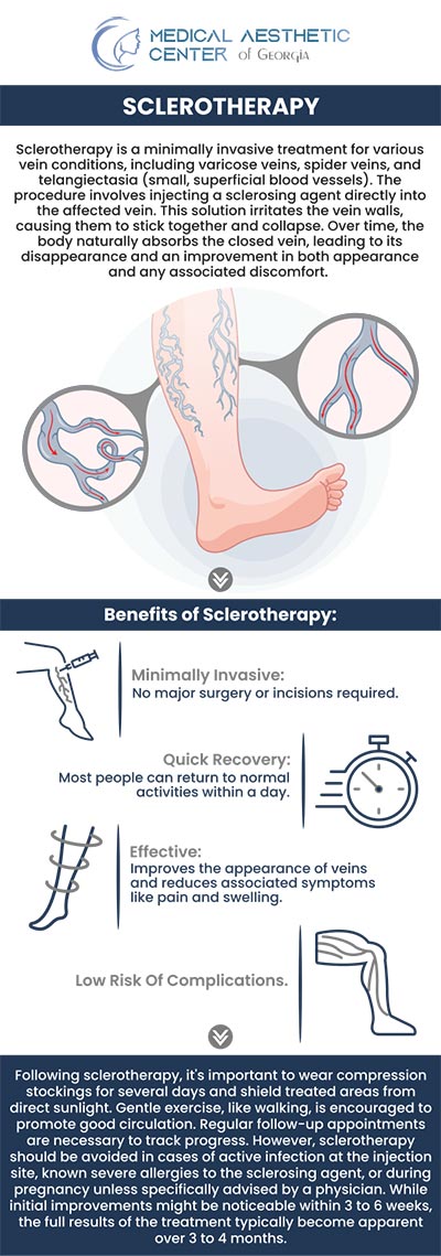 Common questions asked by patients: What is sclerotherapy, and how does it work? What types of veins can be treated with sclerotherapy? How does sclerotherapy compare to laser vein treatments or surgery? What happens during a sclerotherapy session? How long does the procedure usually take? For more information, contact us or request an appointment online. We are conveniently located at 1425 Georgia Ave Suite 201C, Macon, GA 31201.