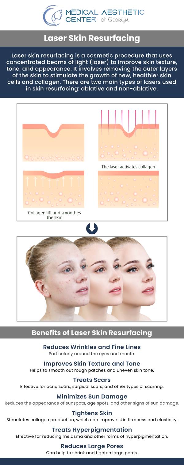 Common questions asked by clients: What is laser resurfacing, and how does it work? What skin concerns can resurfacing lasers treat? How does laser resurfacing differ from chemical peels or microneedling? What happens during a laser resurfacing treatment? For more information, contact us or request an appointment online. We are conveniently located at 1425 Georgia Ave Suite 201C, Macon, GA 31201.