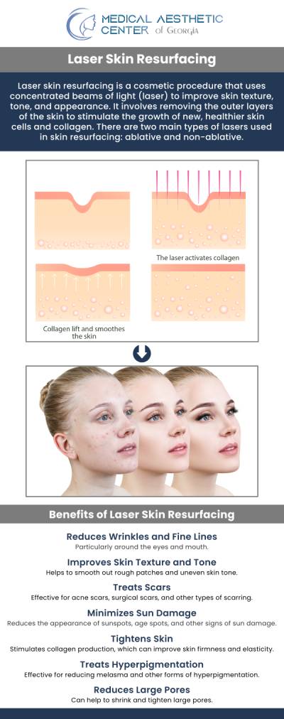 Common questions asked by clients: What is laser resurfacing, and how does it work? What skin concerns can resurfacing lasers treat? How does laser resurfacing differ from chemical peels or microneedling? What happens during a laser resurfacing treatment? For more information, contact us or request an appointment online. We are conveniently located at 1425 Georgia Ave Suite 201C, Macon, GA 31201.