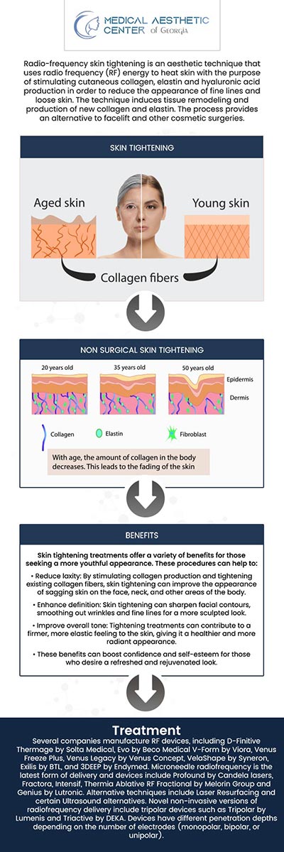 Dr. Reuben K. Ellis, at the Medical Aesthetic Center of Georgia, offers specialized skin tightening treatments in Macon, GA. These advanced, non-invasive procedures are designed to tighten and rejuvenate sagging skin, providing a more youthful and refreshed look. By utilizing the latest technology, we stimulate collagen production to improve skin elasticity and reduce the appearance of fine lines. For more information, contact us or request an appointment online. We are conveniently located at 1425 Georgia Ave Suite 201C, Macon, GA 31201.