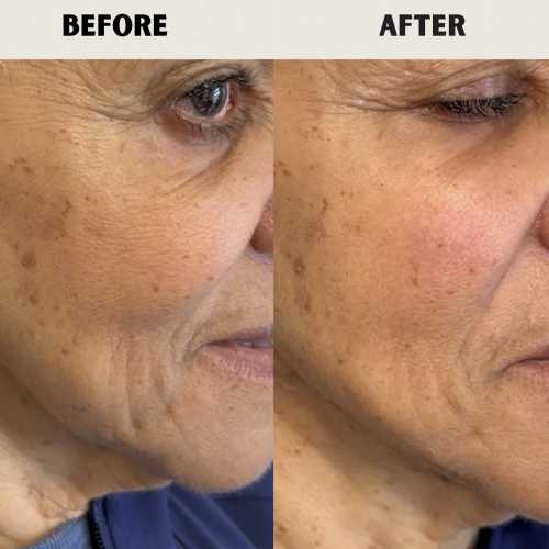 Before & After Treatment Results at Medical Aesthetic Center of Georgia in Macon, GA