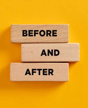 Before and After at Medical Aesthetic Center of Georgia in Macon, GA