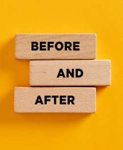 Before and After at Medical Aesthetic Center of Georgia in Macon, GA